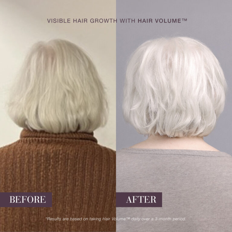 Before-and-after hair showing fuller, shinier hair after using New Nordic Hair Volume™.