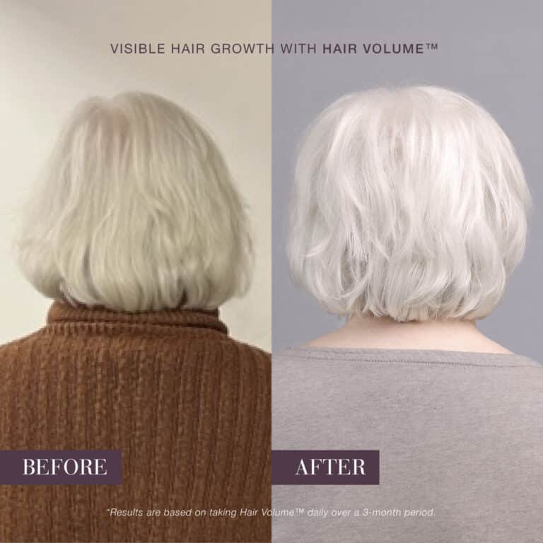 Before-and-after hair showing fuller, shinier hair after using New Nordic Hair Volume™.