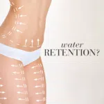 Woman’s body shown with arrows on the skin symbolising body adjustments and text Water retention.