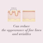 Diagram of skin with and without wrinkles displayed with text Can reduce the appearance of fine lines and wrinkles.