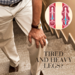 A man with vein problems and the text: tired and heavy legs?