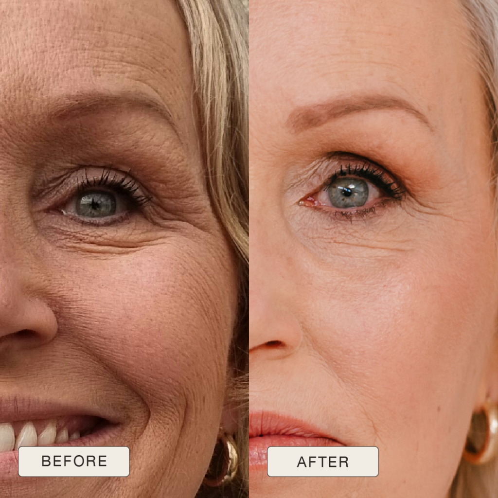 Testimonial Alma, Before and after pictures after use of Natural Magic Skin Care range