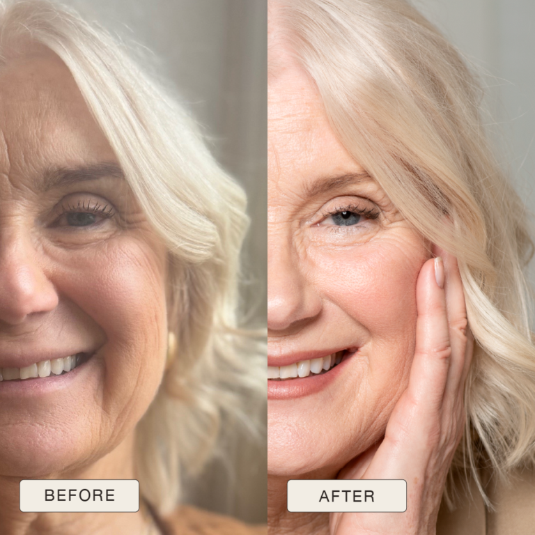 Testimonial Anna, Before and after pictures after use of Natural Magic Skin Care range