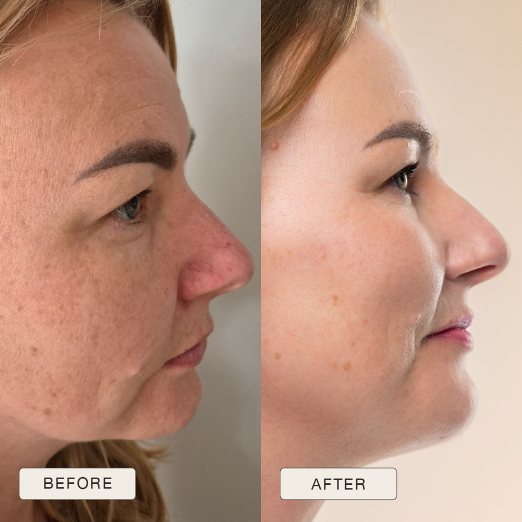 Testimonial Beata, Before and after pictures after use of Natural Magic Skin Care range
