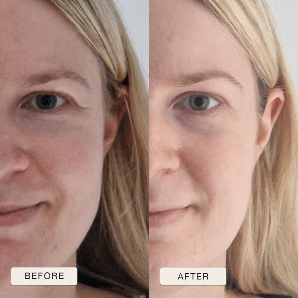 Testimonial Celine, Before and after pictures after use of Natural Magic Skin Care range