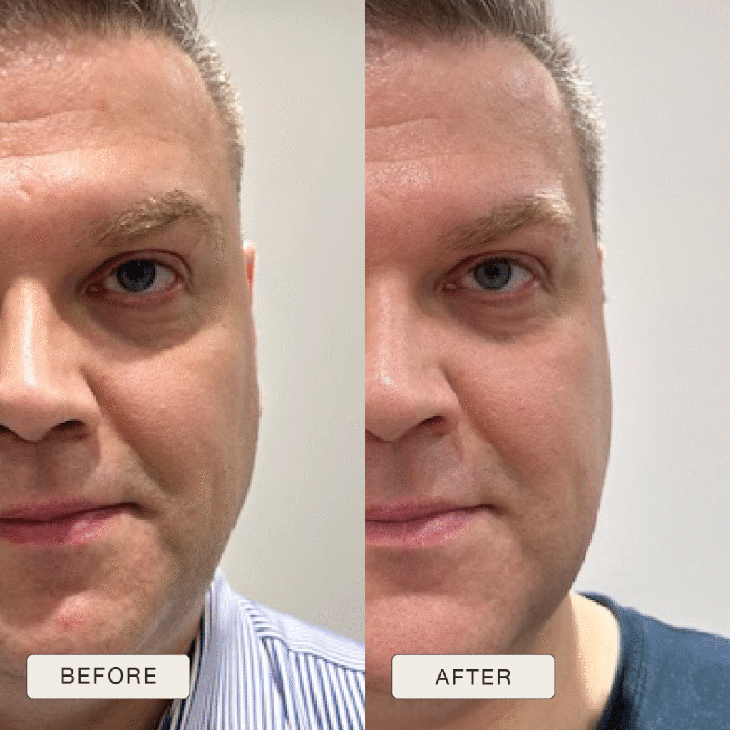 Testimonial Eugenijus, Before and after pictures after use of Natural Magic Skin Care range