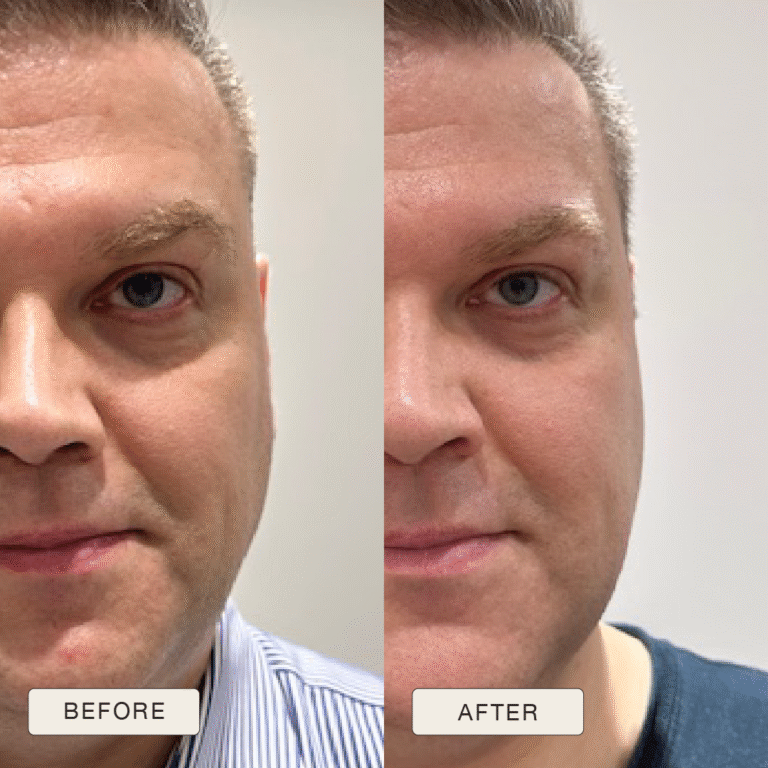 Testimonial Eugenijus, Before and after pictures after use of Natural Magic Skin Care range