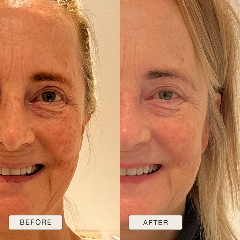 Testimonial Helga, Before and after pictures after use of Natural Magic Skin Care range