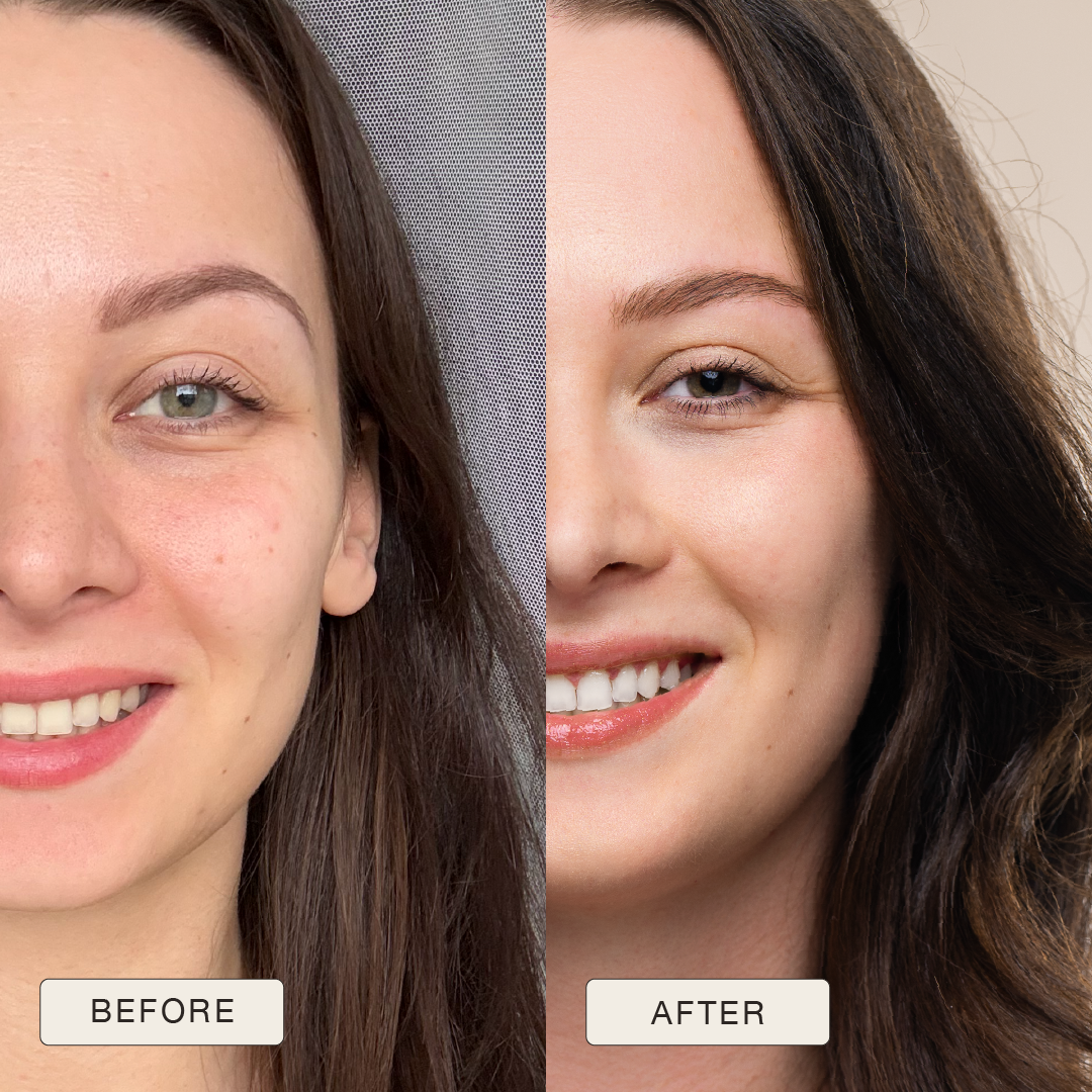 Testimonial Karolina, Before and after pictures after use of Natural Magic Skin Care range