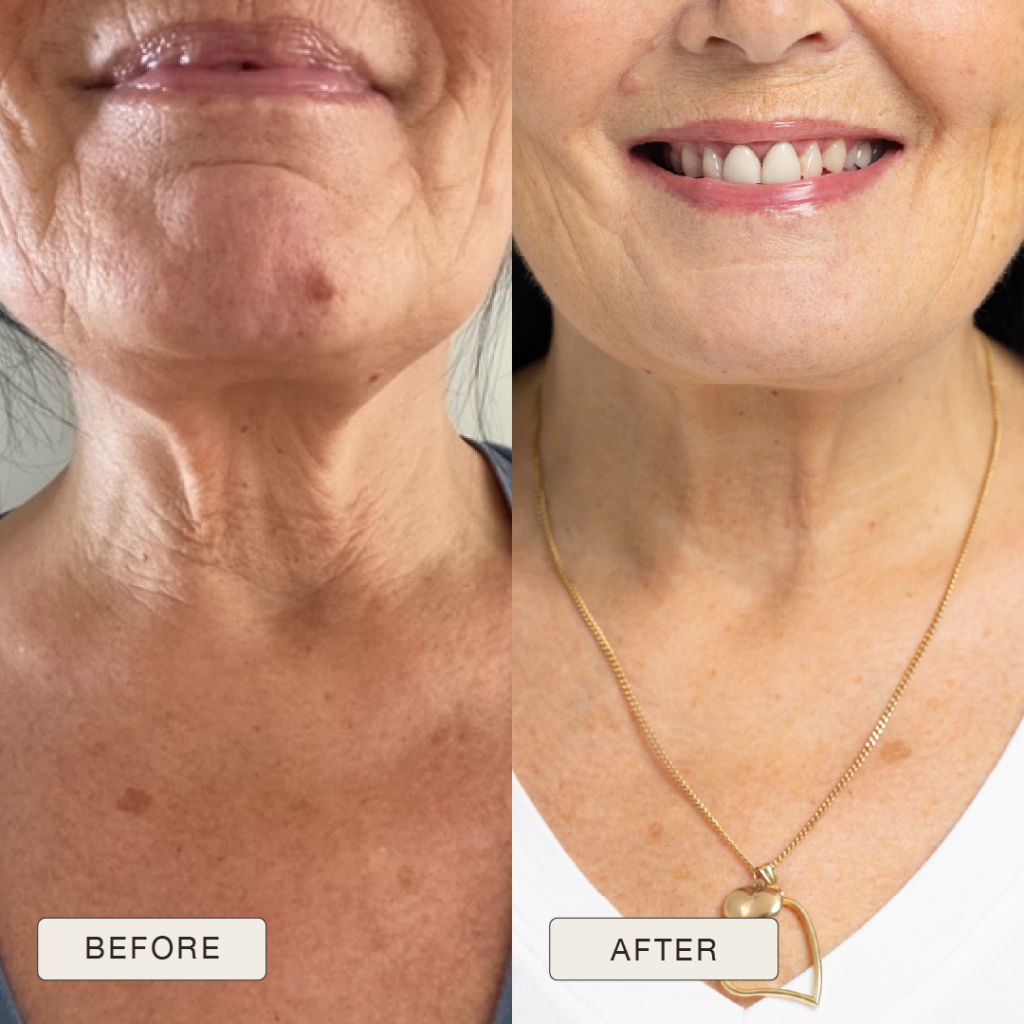 Testimonial Paivi Before and after pictures after use of Natural Magic Skin Care range