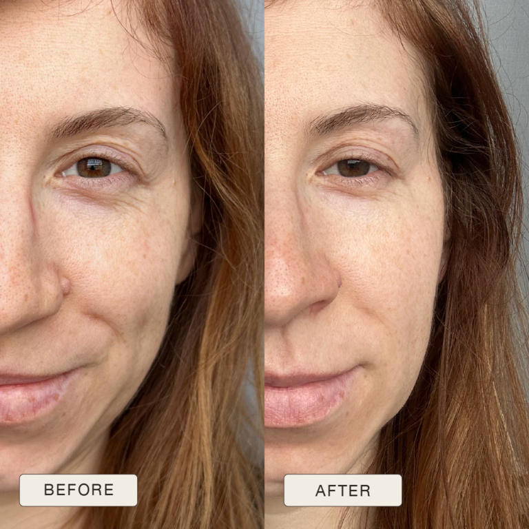 Testimonial Patryija, Before and after pictures after use of Natural Magic Skin Care range