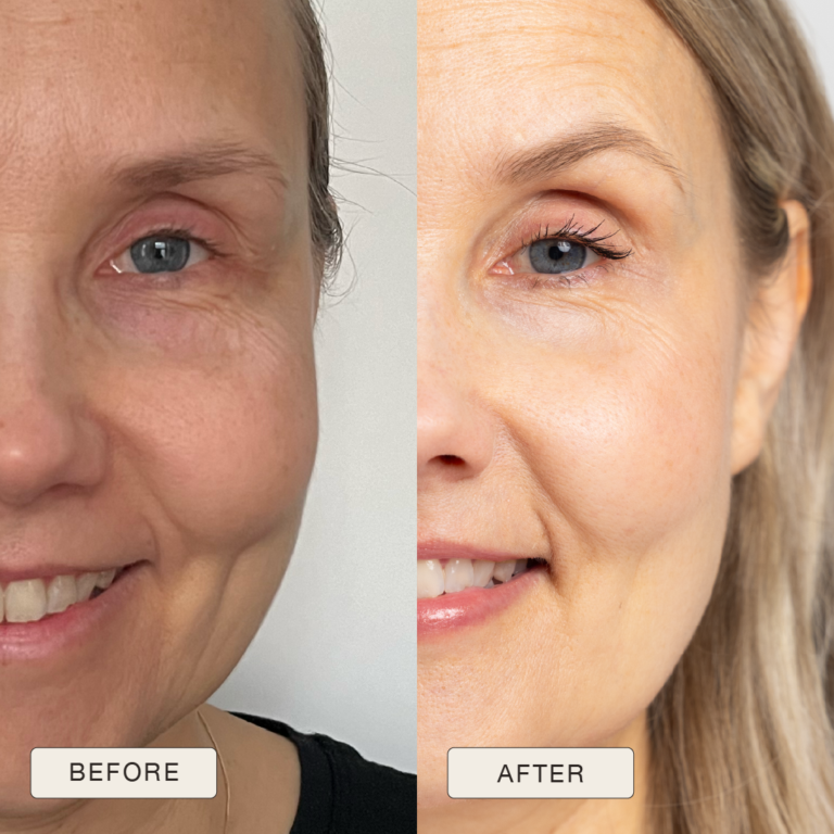 Testimonial Teija Before and after pictures after use of Natural Magic Skin Care range