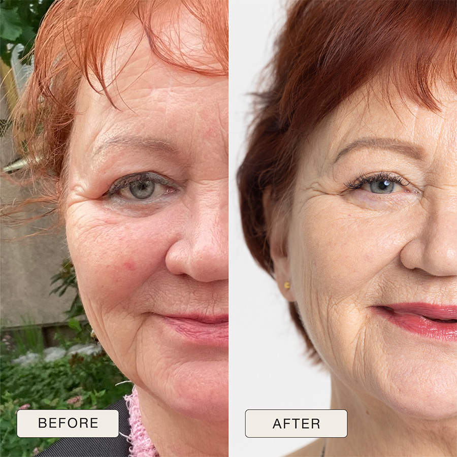 Before and after of an older woman, in the after she is happier and has few wrinkles than before